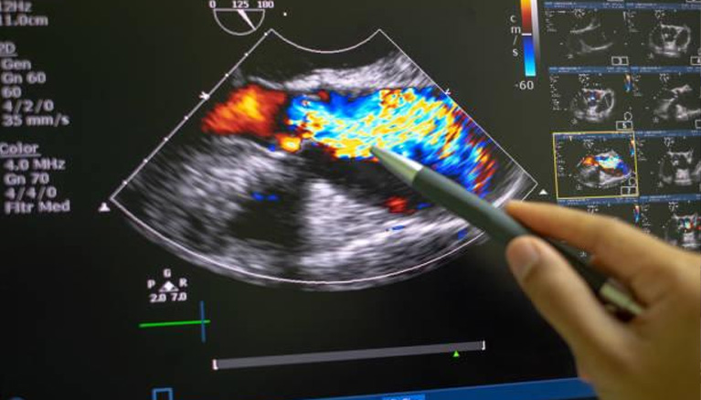 USG & Colour Doppler